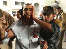 Filistinliler ve İsrail polisi birbirine girdi