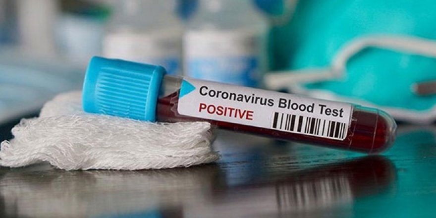 Koronavirüsün zaafını buldular: Aşısı yolda