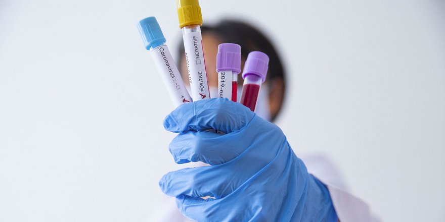Sağlık Bakanlığı karar verdi: Koronavirüs testinde de kriterler değişiyor