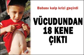 Kene aşısı neden Türkiye'de üretilmiyor